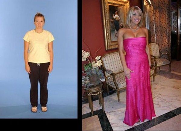  photo remarkable_transformation_08_zps523415bc.jpg